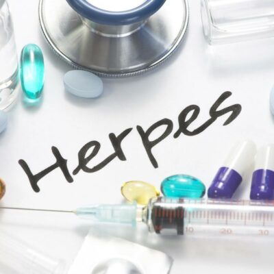 Silent signs and symptoms of herpes