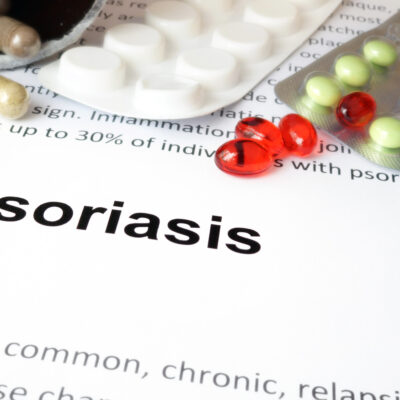 The Worst Foods For Psoriasis And Treatment Options