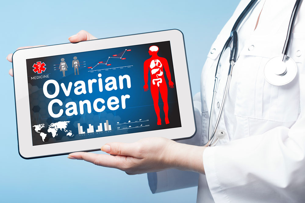 Ovarian Cancer – Stages and Risk Factors