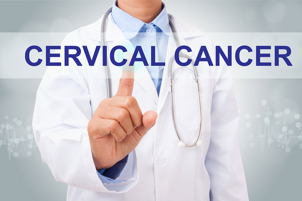 Cervical Cancer – Stages and Risk Factors