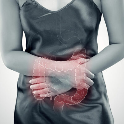 Lifestyle Changes to Help Manage Ulcerative Colitis
