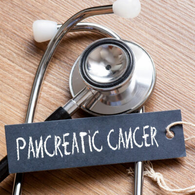 4 Ways to Treat Pancreatic Cancer