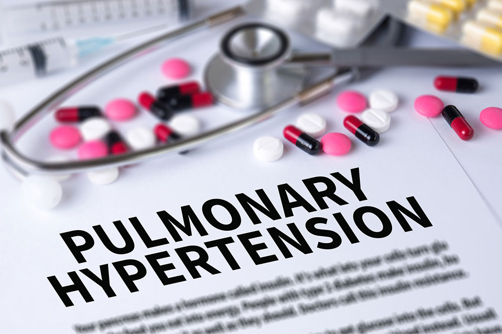 6 Lifestyle Changes for Managing PAH