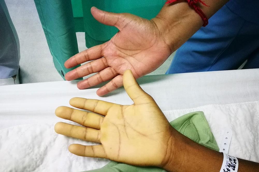 6 Risk Factors for Anemia
