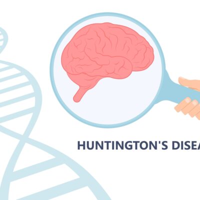 Worst Food For Huntington’s Disease